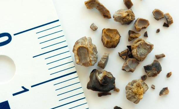 1766231856809391.png a5606f39-eac2-4bc4-b0f1-cef94929445a.png