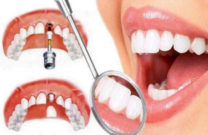 1767538964549501.png bc14f427-5e6a-4464-a8d1-3b54e880d298.png